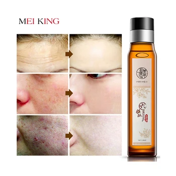 MEIKING Facial Toner Moisturizing Skin Care 100% Natural & Organic Anti Aging Pore Minimizer for Face Nourishes & Hydrates Skin
MEIKING Facial Toner Moisturizing Skin Care 100% Natural & Organic Anti Aging Pore Minimizer for Face Nourishes & Hydrates Skin