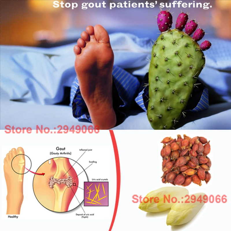 Organic Natural Herbs Remedy for Gout Pain Relief Acute Gout Painful Arthritis Uric Acid Crystallization Treatment 
Organic Natural Herbs Remedy for Gout Pain Relief Acute Gout Painful Arthritis Uric Acid Crystallization Treatment