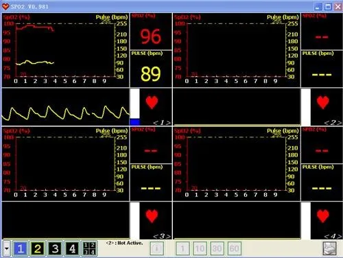 Fingertip Pulse SpO2 Oximeter Blood Oxygen Monitor PLUSBlood Oxygen Saturation saturometre pulsoximeter oximetro de dedo blood
Fingertip Pulse SpO2 Oximeter Blood Oxygen Monitor PLUSBlood Oxygen Saturation saturometre pulsoximeter oximetro de dedo blood