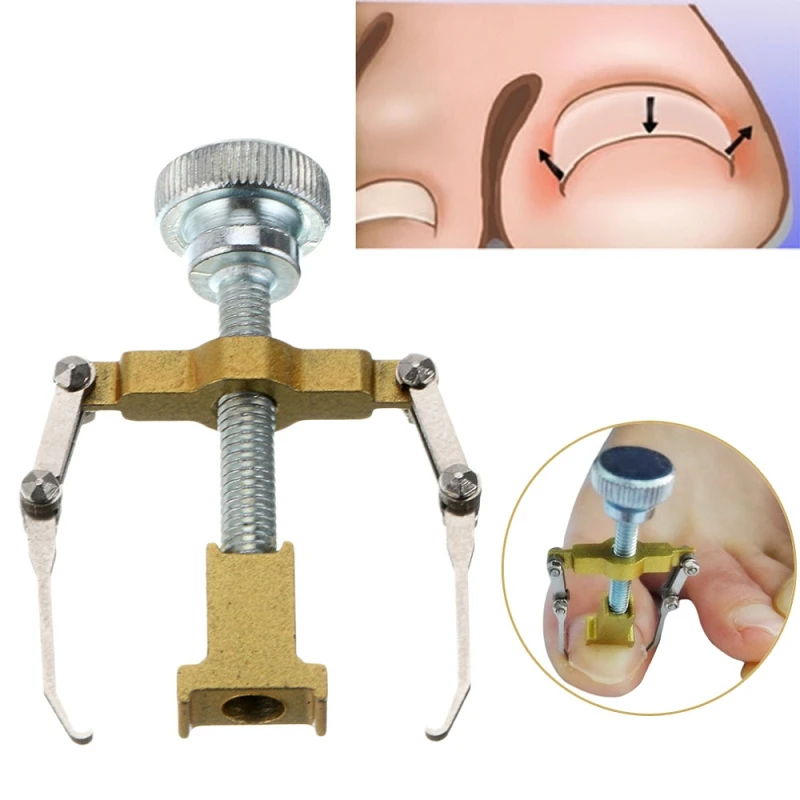 Bend Volume Toenails Braces Support Manicure Toe Paronychia Nail Brace Tools Ingrown Toenails Pedicure Tool #91831
Bend Volume Toenails Braces Support Manicure Toe Paronychia Nail Brace Tools Ingrown Toenails Pedicure Tool #91831
