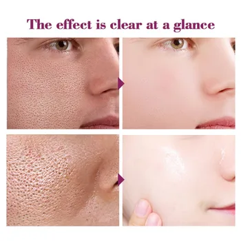 RtopR Glycyrrhiza Face Repair Serum Anti Wrinkle Whitening Oil Control Shrink Pores Care D1
RtopR Glycyrrhiza Face Repair Serum Anti Wrinkle Whitening Oil Control Shrink Pores Care D1