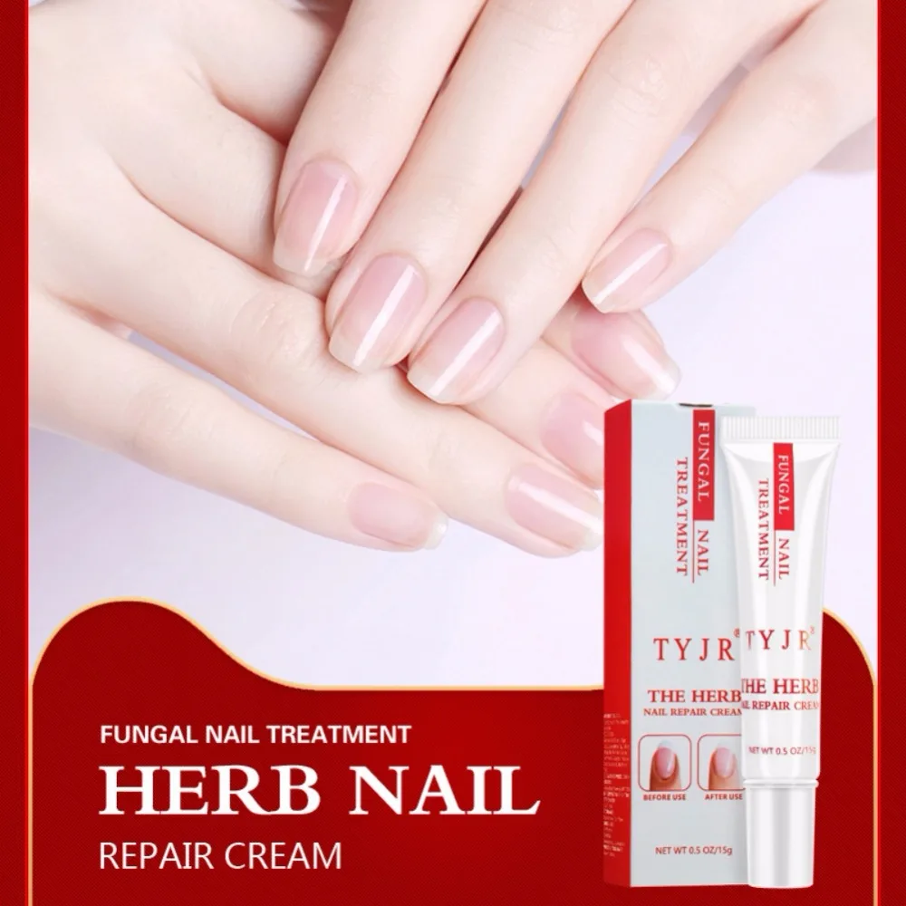 Nail repair Treatment for Toenails and Fingernails Nail Anti-Fungus Onychomycosis Rub Nails Repair Cream
Nail repair Treatment for Toenails and Fingernails Nail Anti-Fungus Onychomycosis Rub Nails Repair Cream