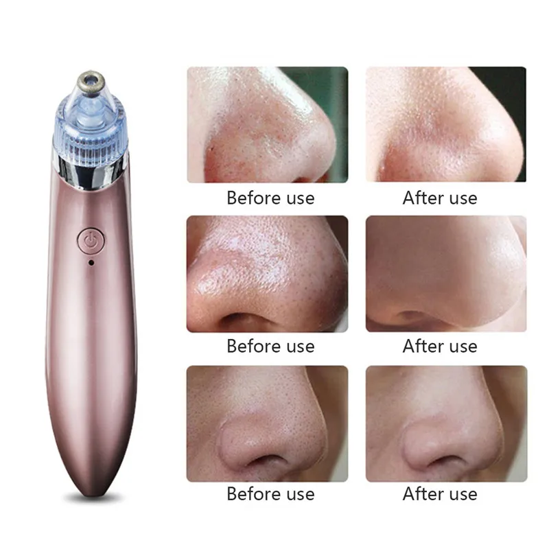 Black Spot Cleaner Facial Cleansing USB Plug Cleaner Face Cleaning Blackhead Machine Acne Removal Face Professional Tools
Black Spot Cleaner Facial Cleansing USB Plug Cleaner Face Cleaning Blackhead Machine Acne Removal Face Professional Tools