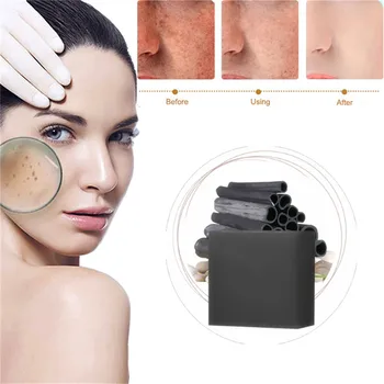 Acne Spot Whitening Face Neck Wrinkles Lifting Removes Pigment Freckle In 7 Days Acne Scar Removal Skin Care Handmade Soap 1Pcs
Acne Spot Whitening Face Neck Wrinkles Lifting Removes Pigment Freckle In 7 Days Acne Scar Removal Skin Care Handmade Soap 1Pcs