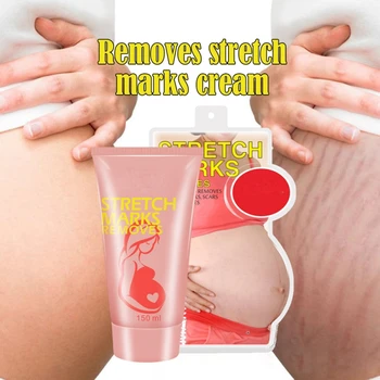 Stretch Mark Removal Cream Lightening Pigment Brighten Skin Tone Skin Repair Essential Cream Pregnancy Repair Cream
Stretch Mark Removal Cream Lightening Pigment Brighten Skin Tone Skin Repair Essential Cream Pregnancy Repair Cream