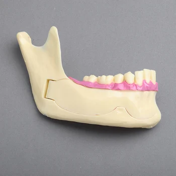 clareador Dental lab ps4 Dentist equipment Comprehensive pathological model of mandible Teeth Study Model
clareador Dental lab ps4 Dentist equipment Comprehensive pathological model of mandible Teeth Study Model