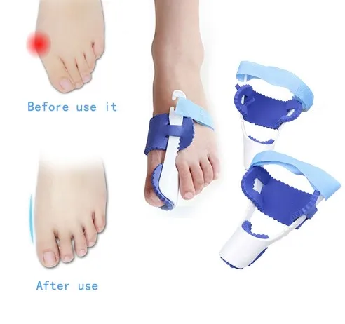 Big Toe Straightener Bunion Orthotics Hallux Valgus Corrector Foot Care Tool Pedicure Device Realign Thumb Bone
Big Toe Straightener Bunion Orthotics Hallux Valgus Corrector Foot Care Tool Pedicure Device Realign Thumb Bone