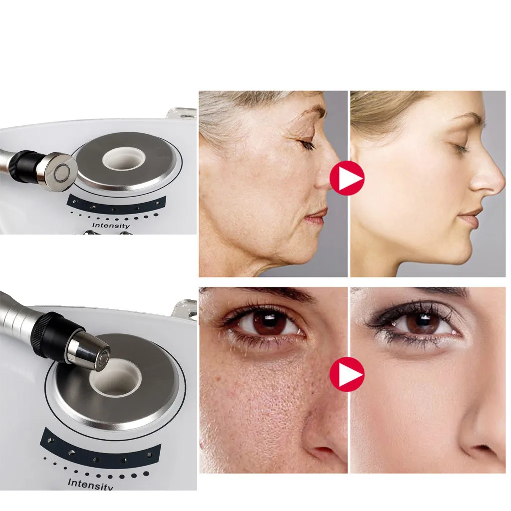 professional Konmison 2 in 1 Home Use Radio Frequency Machine Skin Tightening RF Machine Skin Tightening Beauty FACE Care#G30
professional Konmison 2 in 1 Home Use Radio Frequency Machine Skin Tightening RF Machine Skin Tightening Beauty FACE Care#G30