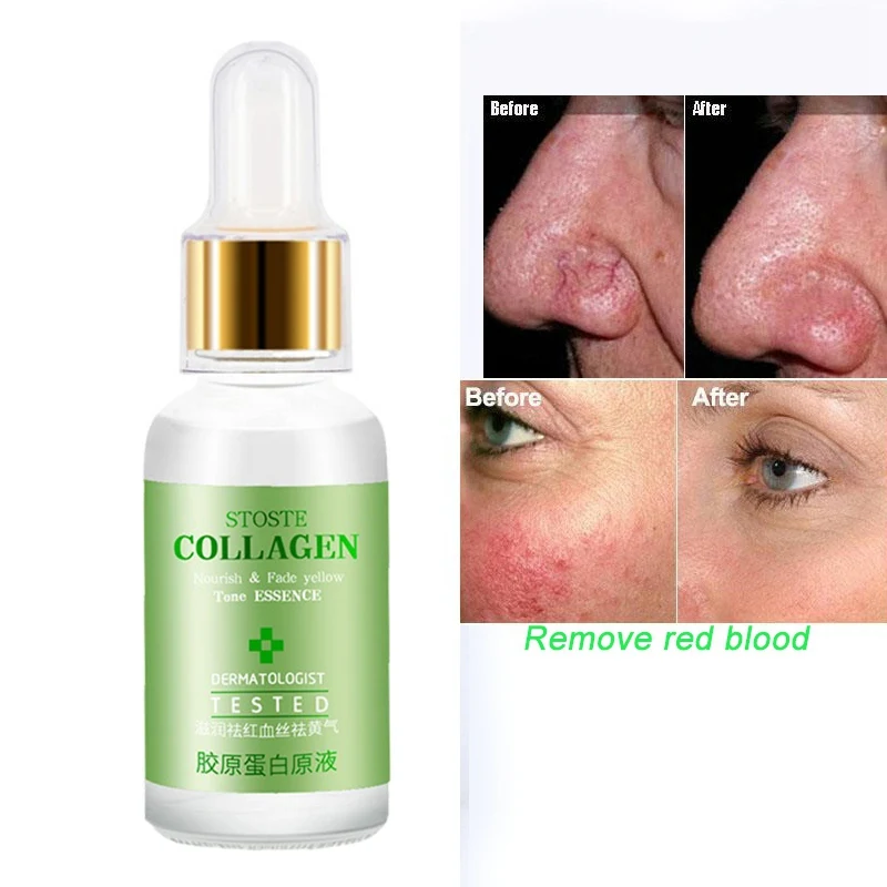 Six Peptides Serum Collagen Liquid Whitening Firming Skin Care Moisturizing Rejuvenating Face Lift Anti-wrinkle Cream
Six Peptides Serum Collagen Liquid Whitening Firming Skin Care Moisturizing Rejuvenating Face Lift Anti-wrinkle Cream