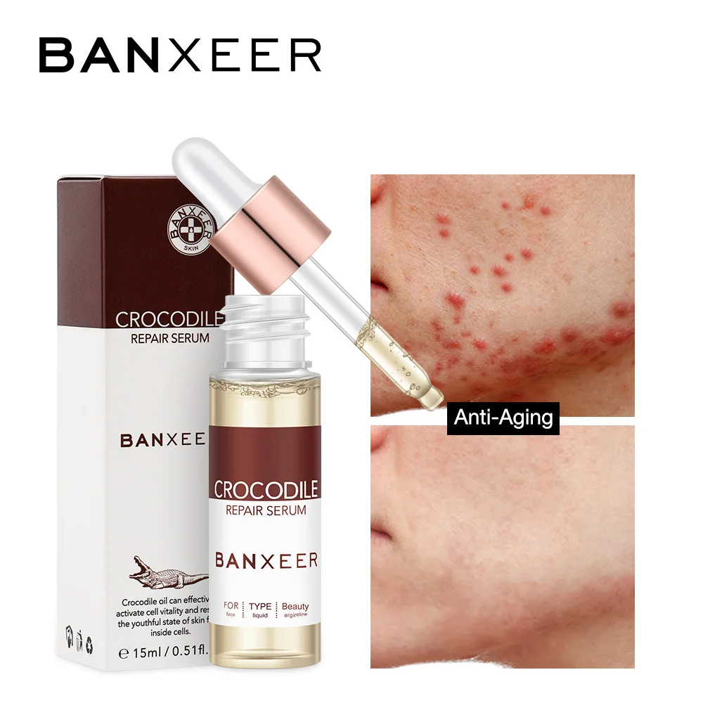 BANXEER Remove Acne Serum Crocodile Repair Scar Face Liquid Essence Whitening for Spots Acne Treatment Stretch Marks Skin Care
BANXEER Remove Acne Serum Crocodile Repair Scar Face Liquid Essence Whitening for Spots Acne Treatment Stretch Marks Skin Care