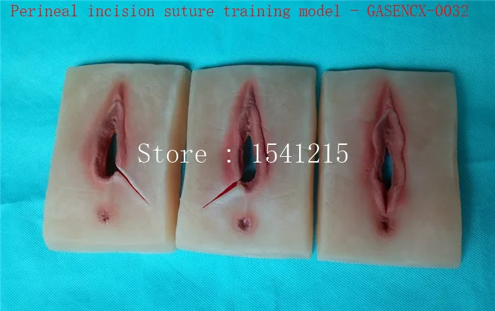 Nursing teaching model of obstetrics and gynecology Female perineal incis Perineal incision suture training model GASENCX-0032
Nursing teaching model of obstetrics and gynecology Female perineal incis Perineal incision suture training model GASENCX-0032