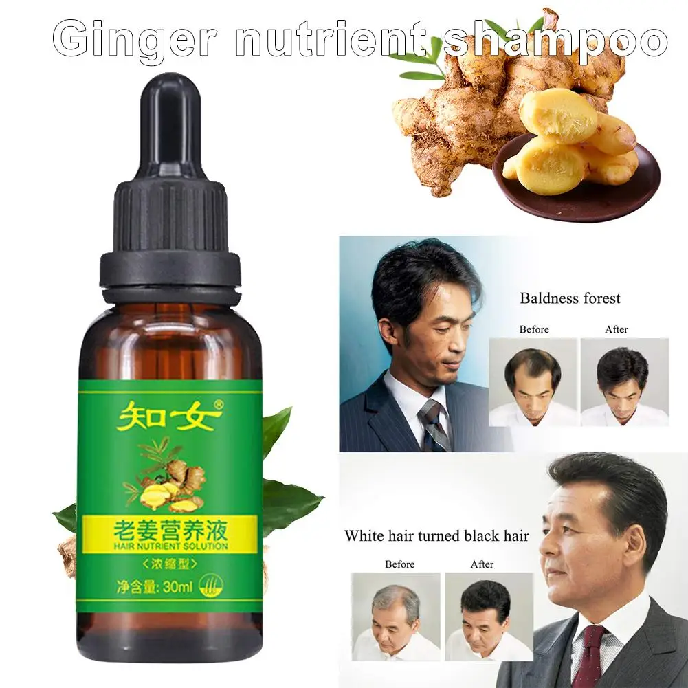 New Sale Hair Growth Serum Ginger Shampoo Conditioner Natural Ingredients For All Hair Types Men Women
New Sale Hair Growth Serum Ginger Shampoo Conditioner Natural Ingredients For All Hair Types Men Women