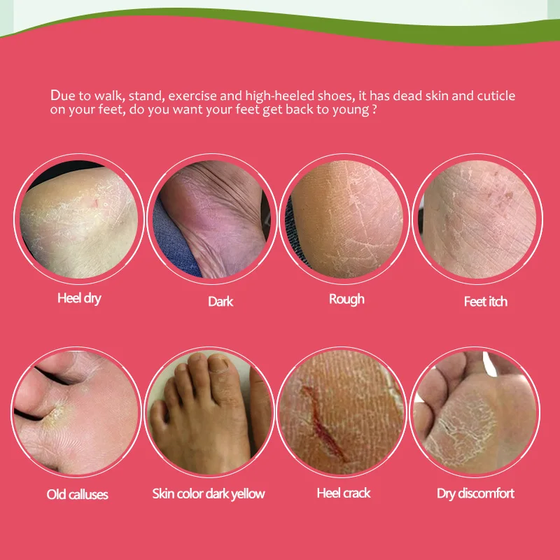 foot-mask-2
