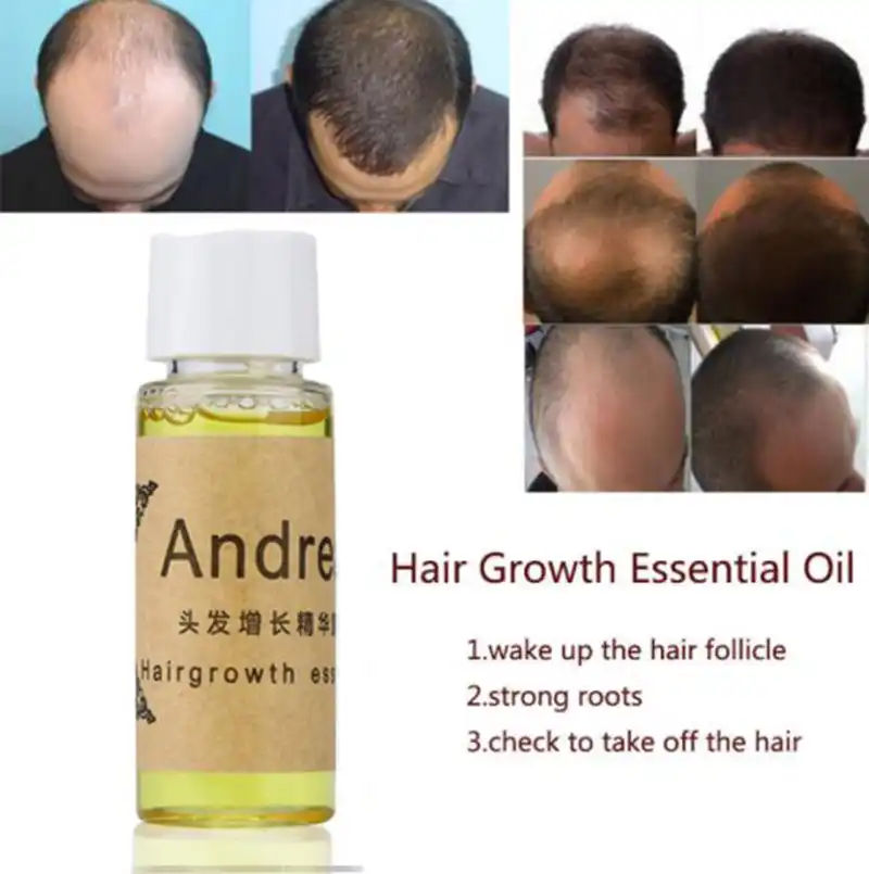 Andrea Hair Growth Anti Hair Loss Liquid 20ml 100 Natural Extract