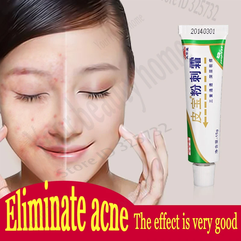 Service Institute Us Russian Wikipedia Facial Spot Treatment