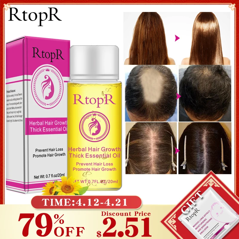 Herbal Hair Growth Anti Hair Loss Liquid Promote Thick Fast Hair Growth Treatment 20ml Essential Oil Health Care Beauty Essence
Herbal Hair Growth Anti Hair Loss Liquid Promote Thick Fast Hair Growth Treatment 20ml Essential Oil Health Care Beauty Essence