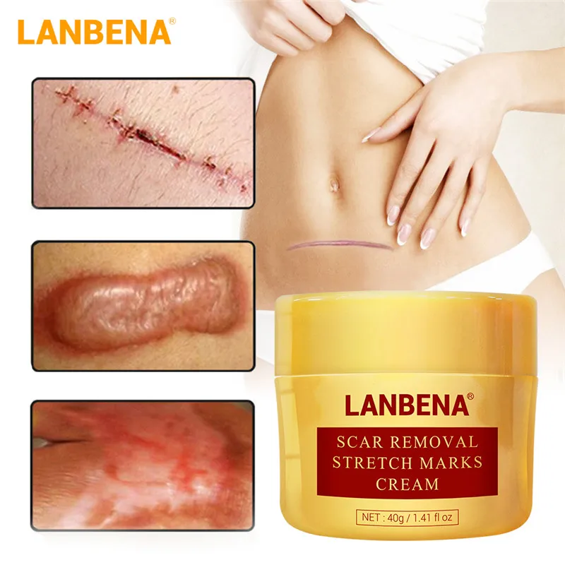 LANBENA upgrate Scar Remove Cream Face Moisturizing Cream Anti Wrinkle Anti Aging Face Fine Lines Acne Treatment Skin Care 40g
LANBENA upgrate Scar Remove Cream Face Moisturizing Cream Anti Wrinkle Anti Aging Face Fine Lines Acne Treatment Skin Care 40g