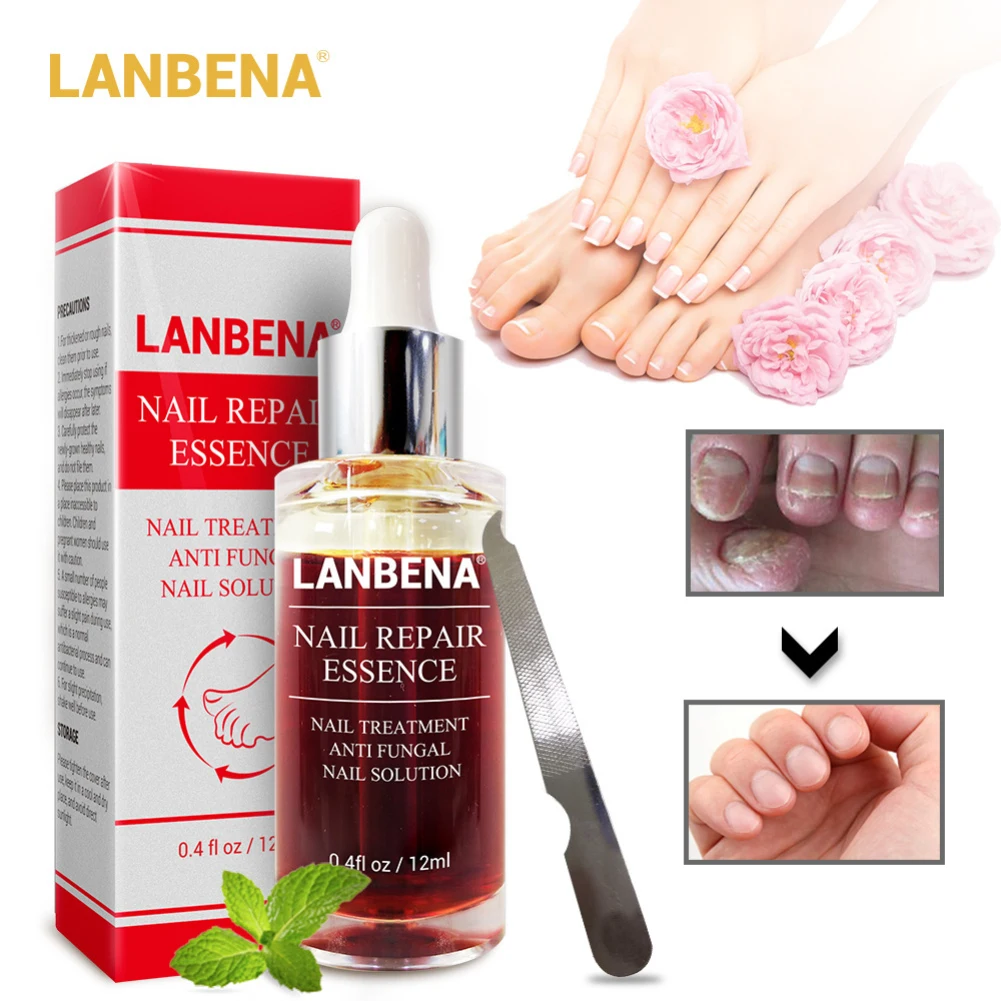 LANBENA Nail Repair Essence Serum Fungal Nail Treatment Remove Onychomycosis Toe Nourishing Brighten Hand Foot Skin Care TSLM1
LANBENA Nail Repair Essence Serum Fungal Nail Treatment Remove Onychomycosis Toe Nourishing Brighten Hand Foot Skin Care TSLM1
