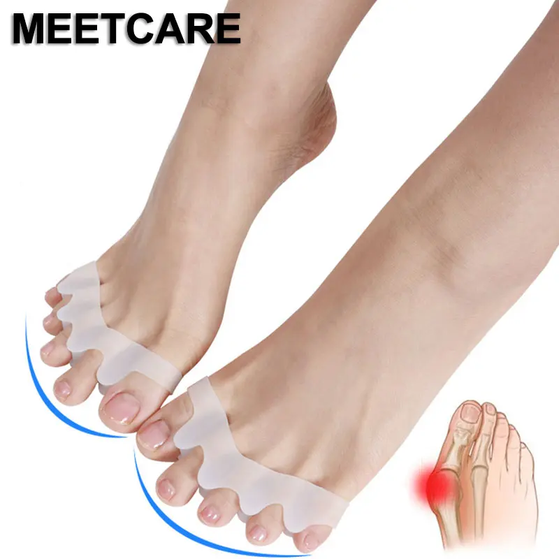 Meetcare Hallux Valgus Correction Braces Overlapping Toe Separator Rehabilitation Treatment Foot Bone Orthotic device Feet Care
Meetcare Hallux Valgus Correction Braces Overlapping Toe Separator Rehabilitation Treatment Foot Bone Orthotic device Feet Care