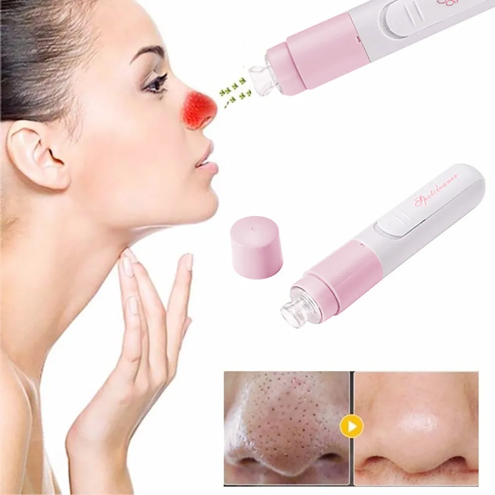 2019 professional Handheld Electric Blackhead Remover Cleaner Vacuum Suction Facia Skin Care Cleaning Tool BB
2019 professional Handheld Electric Blackhead Remover Cleaner Vacuum Suction Facia Skin Care Cleaning Tool BB