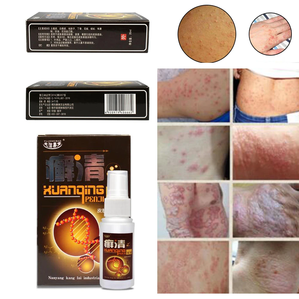 35ML Natural Chinese Medicine Herbal Anti Bacteria Cream Psoriasis Eczema Ointment Treatment High Quality Herbal Cream D246
35ML Natural Chinese Medicine Herbal Anti Bacteria Cream Psoriasis Eczema Ointment Treatment High Quality Herbal Cream D246