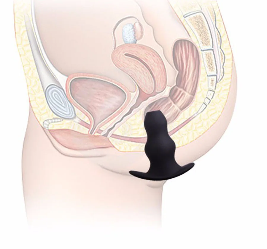 HTB1KUz.OFXXXXXbXpXXq6xXFXXXF