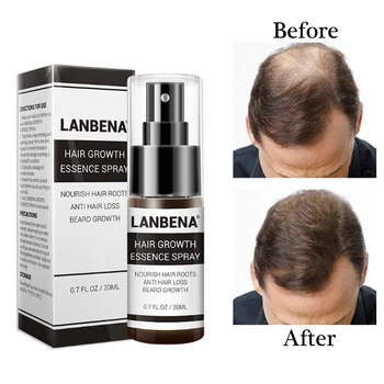 LANBENA Hair Growth Essence Fast Powerful Hair Care Regrowth Essence Hair Loss Treatment for Men and Women Herbal Supplements
LANBENA Hair Growth Essence Fast Powerful Hair Care Regrowth Essence Hair Loss Treatment for Men and Women Herbal Supplements