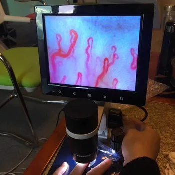 Student microscope microcirculation test machine blood test laboratory equipment
Student microscope microcirculation test machine blood test laboratory equipment