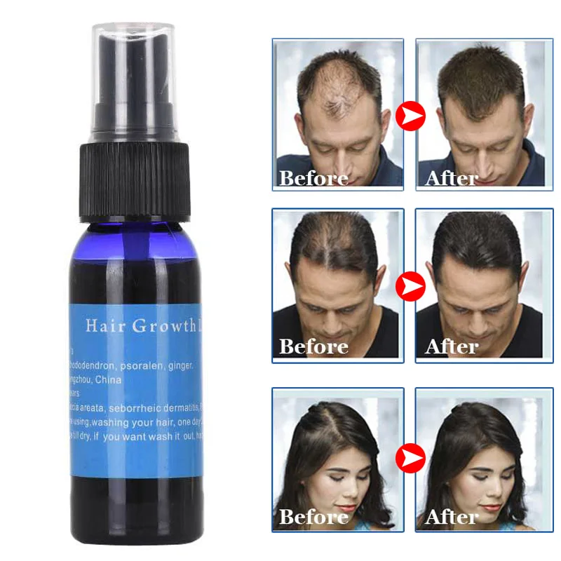 30ml Hair Growth Liquid Hair Care Liquid Restoration Hair Loss Treatment Liquid Dense Essential Oil
30ml Hair Growth Liquid Hair Care Liquid Restoration Hair Loss Treatment Liquid Dense Essential Oil