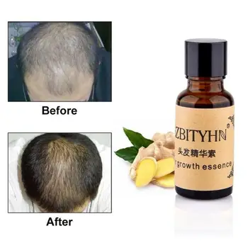 30ml Hair Growth Anti Hair Loss Liquid Dense Dropshipping Hair Hairstyle Keratin Hair Care Products Sunburst
30ml Hair Growth Anti Hair Loss Liquid Dense Dropshipping Hair Hairstyle Keratin Hair Care Products Sunburst