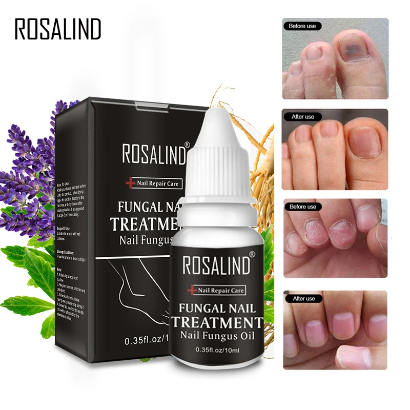 ROSALIND 10ml Nail Fungus Oil 1PCS Repair To Nails Polish Fix Nail Problems Nutrient Solution For Increasing Nail Gloss
ROSALIND 10ml Nail Fungus Oil 1PCS Repair To Nails Polish Fix Nail Problems Nutrient Solution For Increasing Nail Gloss