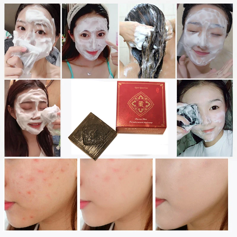 100g Natural Herbal Pimple Pores Blackhead Removal Treatment Oil Control Moisturizing Face Care Wash Base For Soap
100g Natural Herbal Pimple Pores Blackhead Removal Treatment Oil Control Moisturizing Face Care Wash Base For Soap