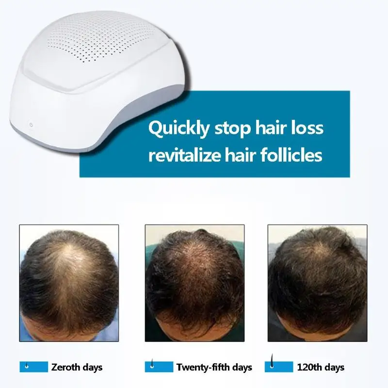 650/678nm Laser Therapy Hair Growth Helmet Device Hair Loss Treatment fast growth cap hair loss solution hair regrowth machin
650/678nm Laser Therapy Hair Growth Helmet Device Hair Loss Treatment fast growth cap hair loss solution hair regrowth machin