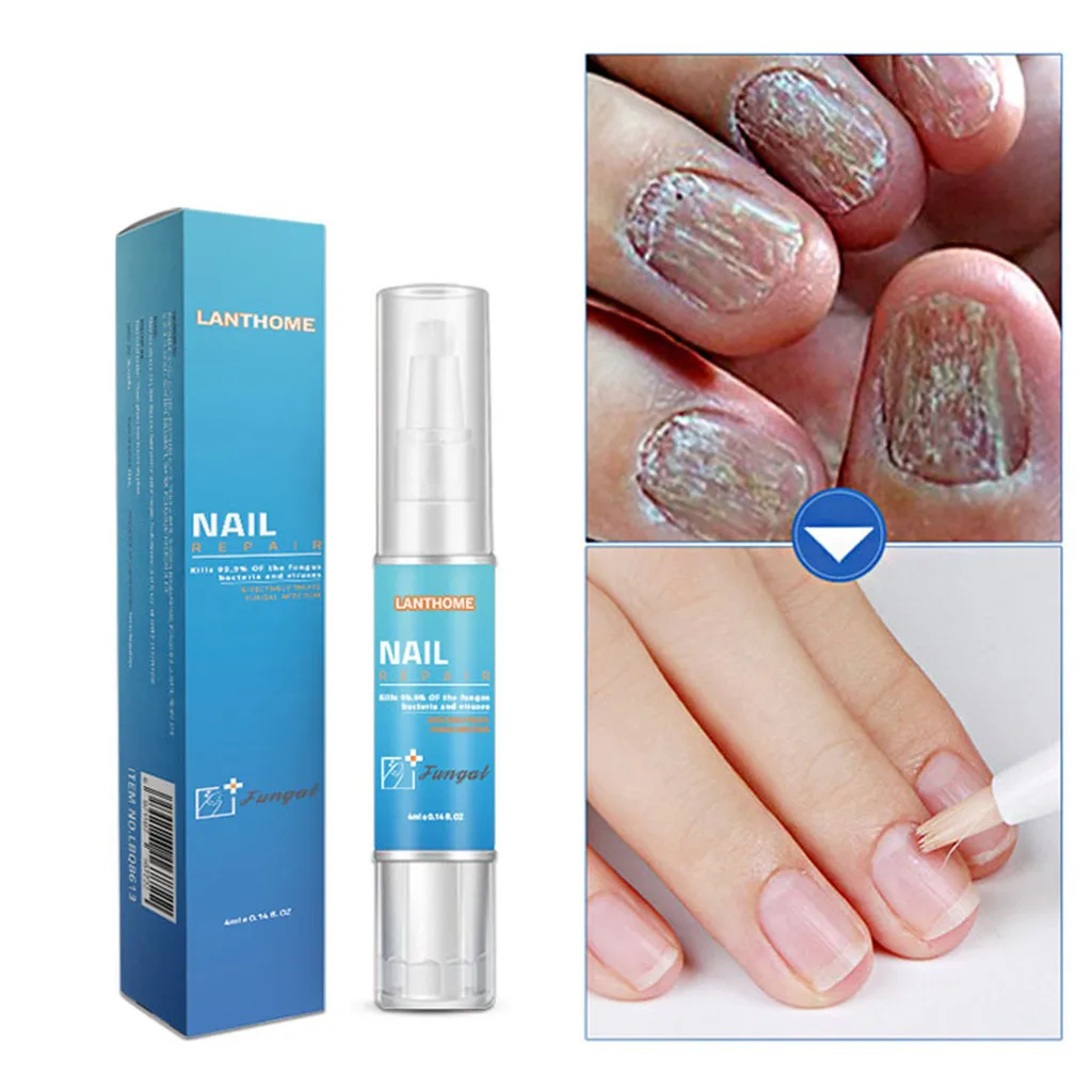 Professional Nail Nutrient Pen Removes Nail Fungus Cuticle Nail Repair Liquid Bright Nail Bio-Protective Film Regen Bio-Pen 45
Professional Nail Nutrient Pen Removes Nail Fungus Cuticle Nail Repair Liquid Bright Nail Bio-Protective Film Regen Bio-Pen 45