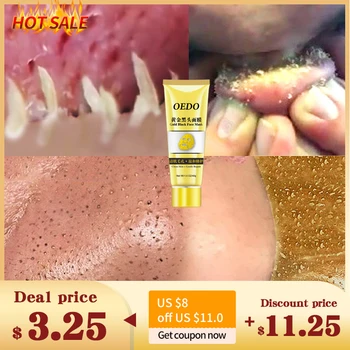 Gold Remove Blackhead Mask Shrink Pore Improve Rough Skin Acne Shills Blackhead Remover Mask Facial Moisturizing Cream#
Gold Remove Blackhead Mask Shrink Pore Improve Rough Skin Acne Shills Blackhead Remover Mask Facial Moisturizing Cream#
