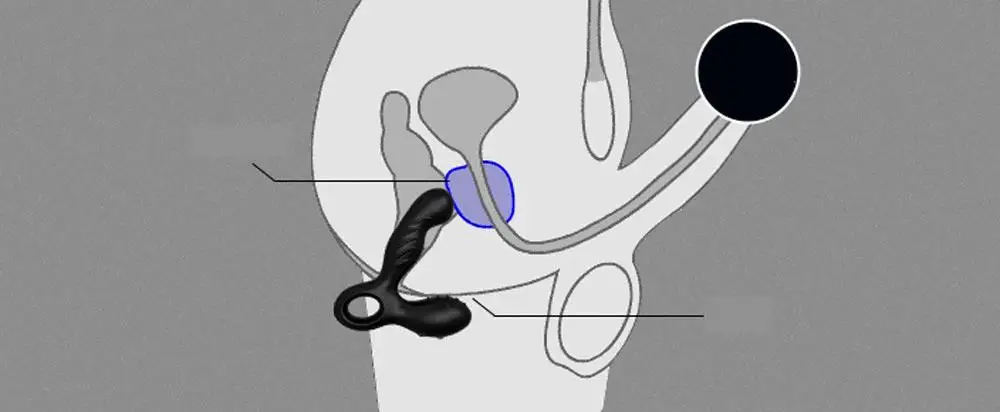 Анальные Вибраторы Для Массажа Простаты