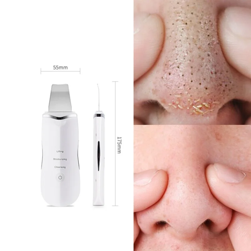 Ultrasonic Facial Pore Cleaner Deeply Cleaning Device Skin Scrubber Massager Machine Anion Face Care wholesale
Ultrasonic Facial Pore Cleaner Deeply Cleaning Device Skin Scrubber Massager Machine Anion Face Care wholesale