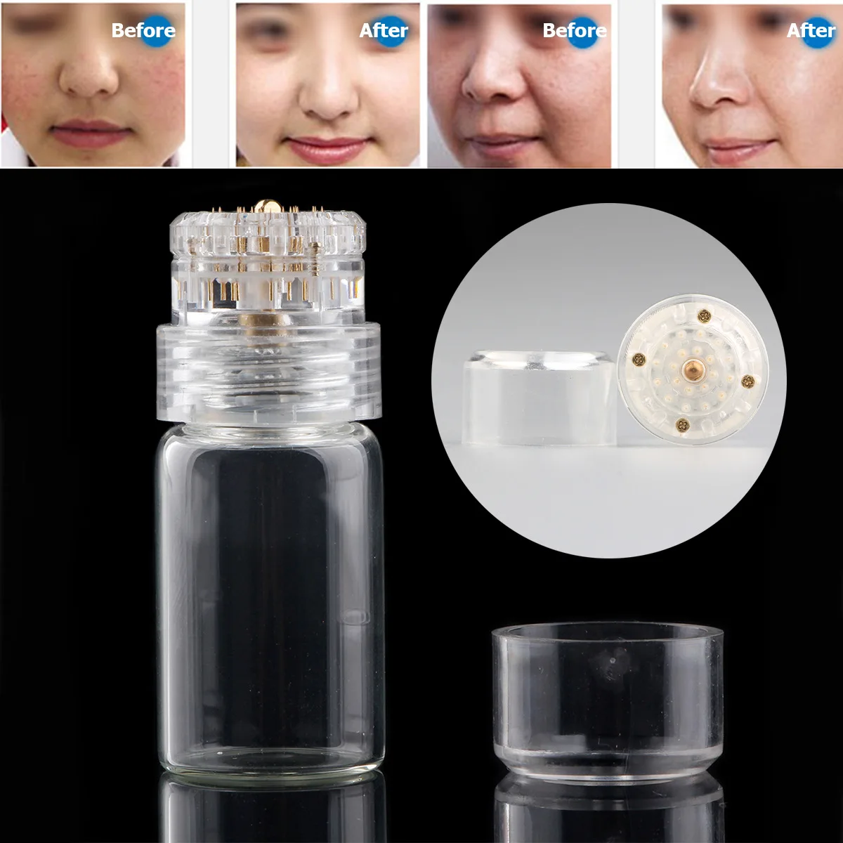 0.5mm Hydra Needle 20 Micro Needle Titanium Tips Bottle Derma Stamp Needles Skin Care Anti Aging Serum Injection Reusable TSLM1
0.5mm Hydra Needle 20 Micro Needle Titanium Tips Bottle Derma Stamp Needles Skin Care Anti Aging Serum Injection Reusable TSLM1