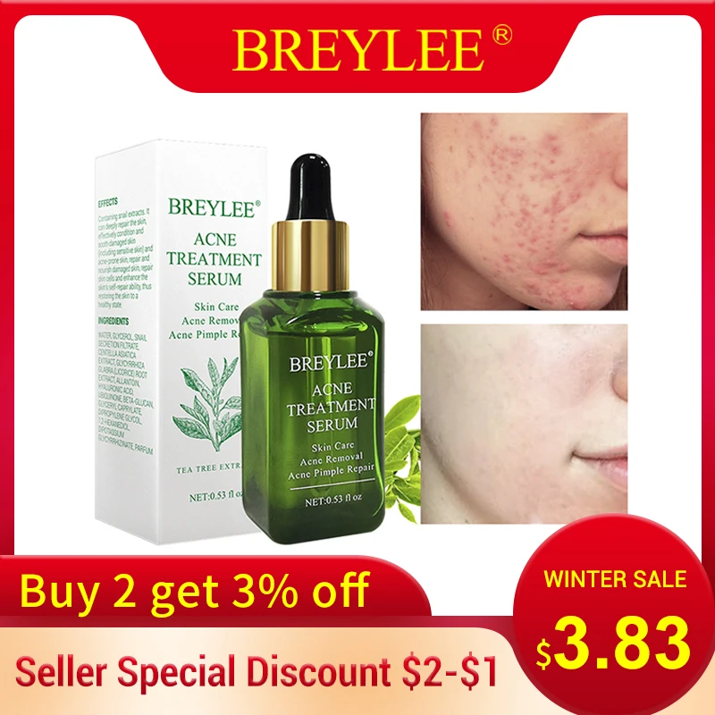 BREYLEE Acne Treatment Facial Essence Anti Acne Serum Scar Remover Cream Face Skin Care Whitening Repair Pimple Remover For Acne
BREYLEE Acne Treatment Facial Essence Anti Acne Serum Scar Remover Cream Face Skin Care Whitening Repair Pimple Remover For Acne