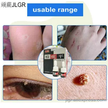 Skin Care Removing Wart Corns Wart Removal Beauty Care Corn Remover Warts Thorn Plaster Patch Feet Callus Removal Tool Skin Tag
Skin Care Removing Wart Corns Wart Removal Beauty Care Corn Remover Warts Thorn Plaster Patch Feet Callus Removal Tool Skin Tag