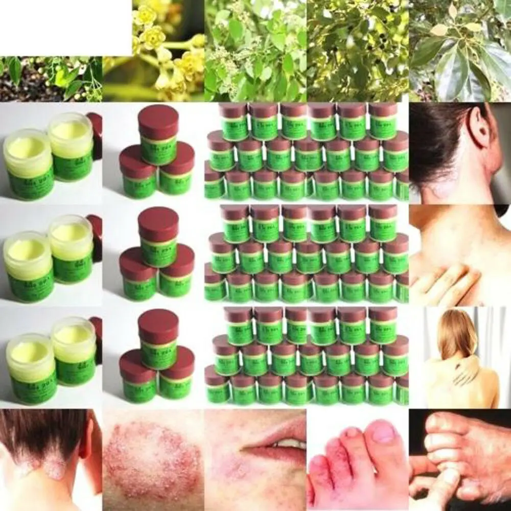 29A Natural Cream Cure Psoriasis Ointment Ringworm Cream Tinea Eczema Psoriasi Eczma Skin CARE Treatment All Skin Types TSLM1
29A Natural Cream Cure Psoriasis Ointment Ringworm Cream Tinea Eczema Psoriasi Eczma Skin CARE Treatment All Skin Types TSLM1