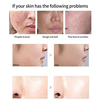 Golden Snail Secretion Essence Anti-aging Firming Moisturizng Facial Essence MH88
Golden Snail Secretion Essence Anti-aging Firming Moisturizng Facial Essence MH88