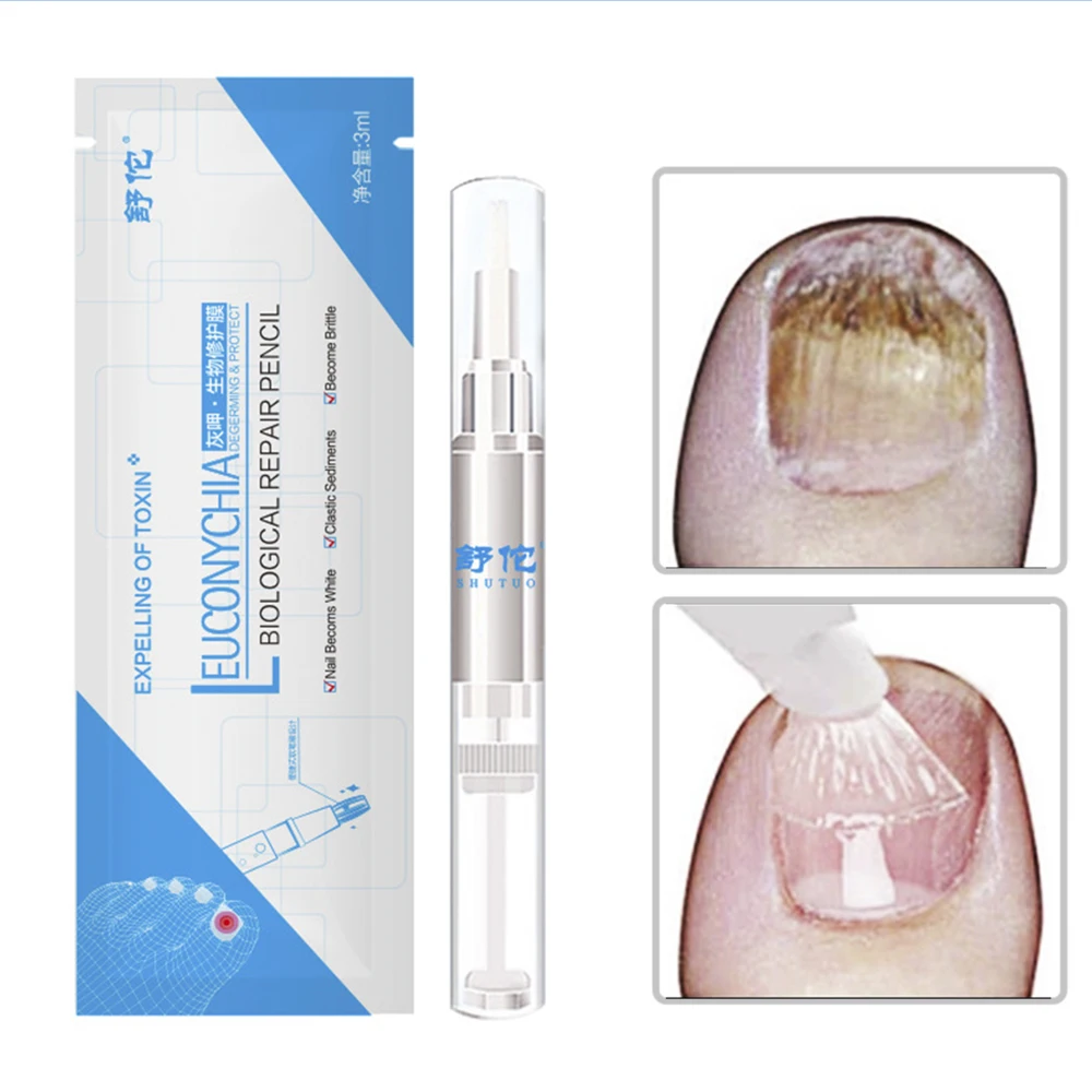 Nail Fungal Treatment Pen Nail Repair Pencil Antibacterial FIlm Anti Fungus Infection Biological Repair Solution Nutritious Oil
Nail Fungal Treatment Pen Nail Repair Pencil Antibacterial FIlm Anti Fungus Infection Biological Repair Solution Nutritious Oil