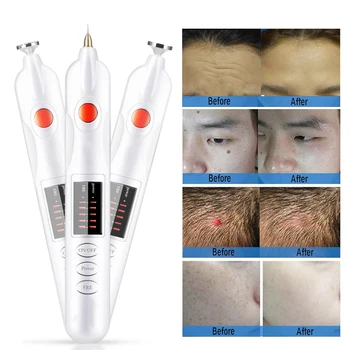 Professional Freckle Wrinkle Mole Tattoo Removal Pen Powerful Plug-in Scar Tattoo Remove Machine Electric Magic Ionic Plasma Pen
Professional Freckle Wrinkle Mole Tattoo Removal Pen Powerful Plug-in Scar Tattoo Remove Machine Electric Magic Ionic Plasma Pen