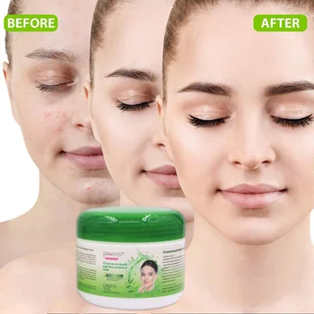 Facial Cream Nourishing Acne Treatment Moisturizer Whitening Repair Face Green Tea Cream
Facial Cream Nourishing Acne Treatment Moisturizer Whitening Repair Face Green Tea Cream