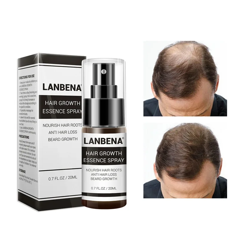 LANBENA New Hair Growth Essence Spray Anti Hair Loss Preventing Baldness Consolidating Nourish Protable Hair Care Hotest
LANBENA New Hair Growth Essence Spray Anti Hair Loss Preventing Baldness Consolidating Nourish Protable Hair Care Hotest