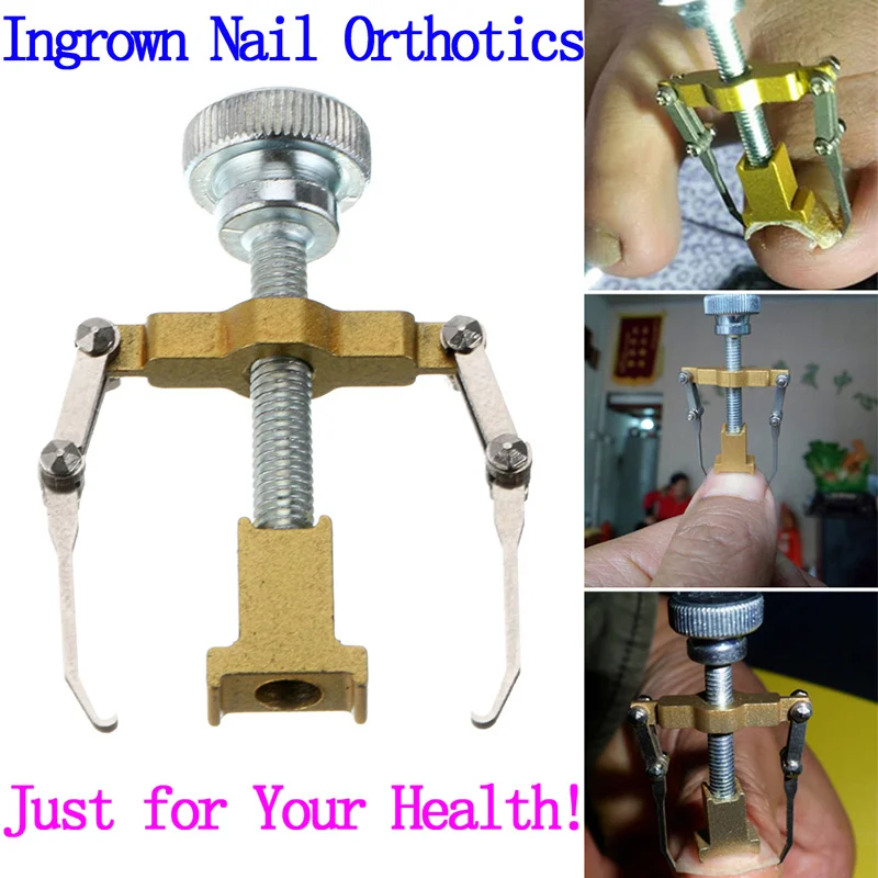 Adomaner Ingrown Toenails Fixer Orthotics Toe Nail Recover Correction Tool Foot Nail Care Device Manicure Pedicure Set Machine
Adomaner Ingrown Toenails Fixer Orthotics Toe Nail Recover Correction Tool Foot Nail Care Device Manicure Pedicure Set Machine