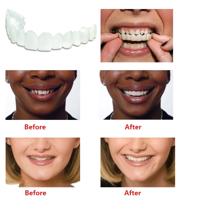 Teeth Whitening Snap On Smile Teeth Cosmetic Denture Instant Perfect Smile Teeth Fake Tooth Cover One Size Fits Teeth Beauty
Teeth Whitening Snap On Smile Teeth Cosmetic Denture Instant Perfect Smile Teeth Fake Tooth Cover One Size Fits Teeth Beauty