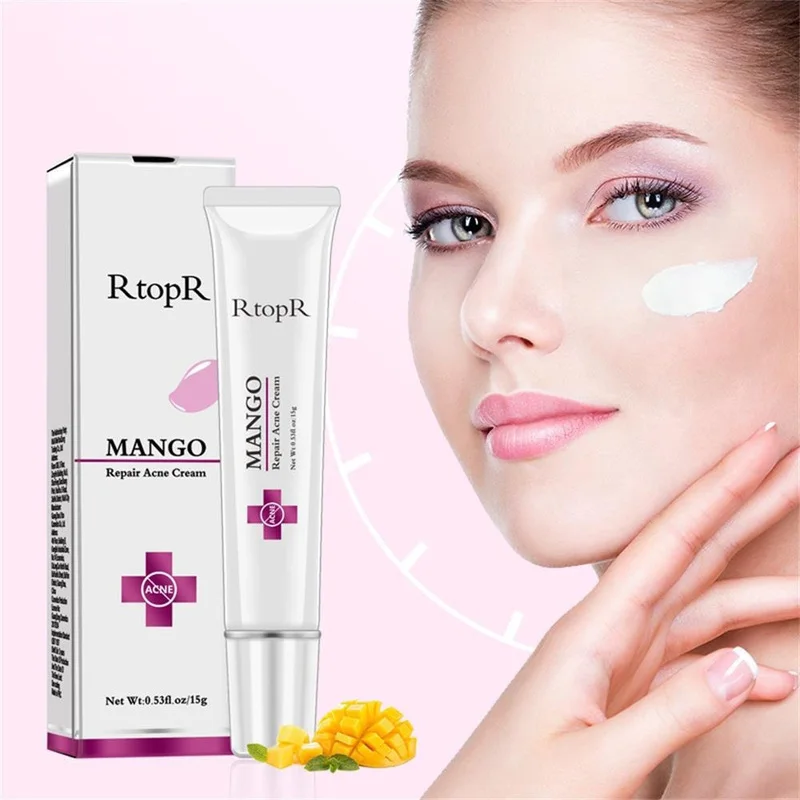 Anti Stains Acne Treatment Scar Blackhead Cream Shrink Pores Whitening Moisturizing Face Skin Care Mango Repair Acne Cream TSLM1
Anti Stains Acne Treatment Scar Blackhead Cream Shrink Pores Whitening Moisturizing Face Skin Care Mango Repair Acne Cream TSLM1