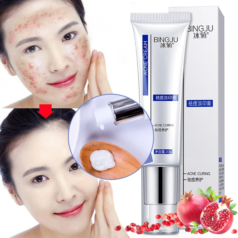 Face Acne Cleaning Cream Quickly Remover Anti Acne Treatment Oil Control Skin Repair Shrink Pores Acne Scar Whitening Cream 30g
Face Acne Cleaning Cream Quickly Remover Anti Acne Treatment Oil Control Skin Repair Shrink Pores Acne Scar Whitening Cream 30g